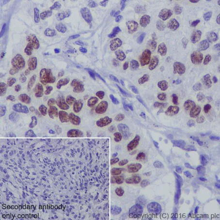 Immunohistochemistry (Formalin/PFA-fixed paraffin-embedded sections) - Anti-p73 antibody [EPR19884] - BSA and Azide free (AB251550)