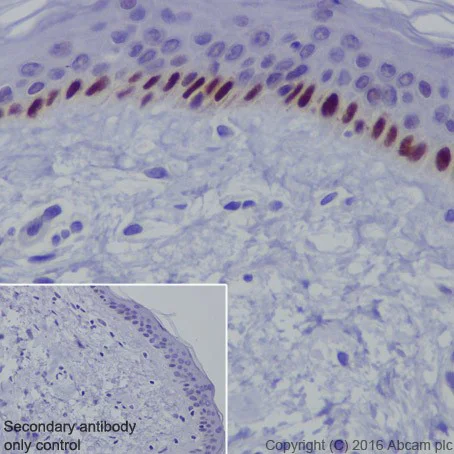 Immunohistochemistry (Formalin/PFA-fixed paraffin-embedded sections) - Anti-p73 antibody [EPR19884] - BSA and Azide free (AB251550)