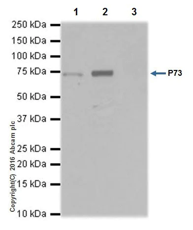 Immunoprecipitation - Anti-p73 antibody [EPR19884] - BSA and Azide free (AB251550)