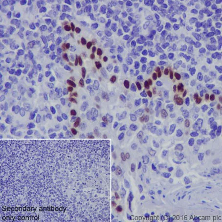 Immunohistochemistry (Formalin/PFA-fixed paraffin-embedded sections) - Anti-p73 antibody [EPR19884] - ChIP Grade (AB215038)