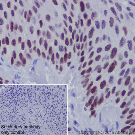Immunohistochemistry (Formalin/PFA-fixed paraffin-embedded sections) - Anti-p73 antibody [EPR19884] - ChIP Grade (AB215038)