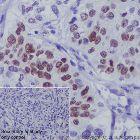 Immunohistochemistry (Formalin/PFA-fixed paraffin-embedded sections) - Anti-p73 antibody [EPR19884] - ChIP Grade (AB215038)
