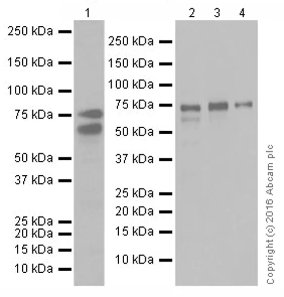 Western blot - Anti-p73 antibody [EPR19884] - ChIP Grade (AB215038)