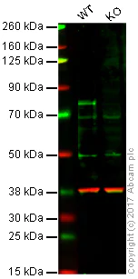 Western blot - Anti-p73 antibody [EPR19884] - ChIP Grade (AB215038)