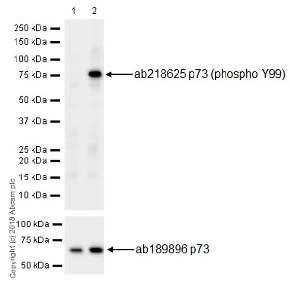 Western blot - Anti-p73 (phospho Y99) antibody [EPR21751] (AB218625)