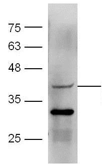 Western blot - Anti-p75 NGF Receptor antibody (AB216495)