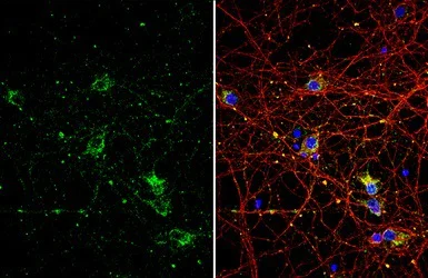 Immunocytochemistry/ Immunofluorescence - Anti-p75 NGF Receptor antibody (AB227509)