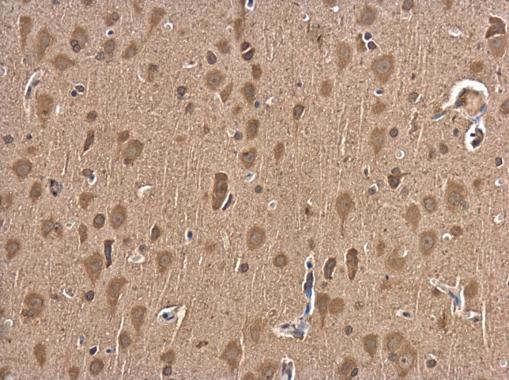 Immunohistochemistry (Formalin/PFA-fixed paraffin-embedded sections) - Anti-p75 NGF Receptor antibody (AB227509)