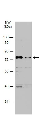 Western blot - Anti-p75 NGF Receptor antibody (AB227509)