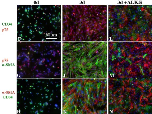 Immunocytochemistry/ Immunofluorescence - Anti-p75 NGF Receptor antibody [EP1039Y] (AB52987)
