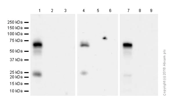 Western blot - Anti-p75 NGF Receptor antibody [EP1039Y] (AB52987)