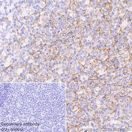 Immunohistochemistry (Formalin/PFA-fixed paraffin-embedded sections) - Anti-p75 NGF Receptor antibody [EP1039Y] - BSA and Azide free (AB256584)