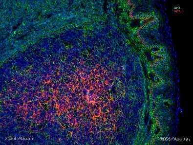 Immunohistochemistry (Formalin/PFA-fixed paraffin-embedded sections) - Anti-p75 NGF Receptor antibody [EP1039Y] - BSA and Azide free (AB256584)