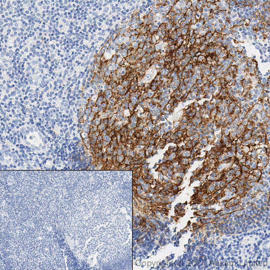 Immunohistochemistry (Formalin/PFA-fixed paraffin-embedded sections) - Anti-p75 NGF Receptor antibody [EP1039Y] - BSA and Azide free (AB256584)