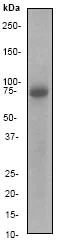 Western blot - Anti-p75 NGF Receptor antibody [EP1039Y] - BSA and Azide free (AB256584)