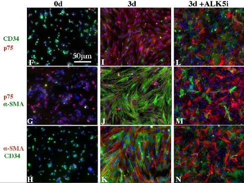 Immunocytochemistry/ Immunofluorescence - Anti-p75 NGF Receptor antibody [EP1039Y] - Low endotoxin, Azide free (AB221212), expandable thumbnail