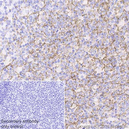 Immunohistochemistry (Formalin/PFA-fixed paraffin-embedded sections) - Anti-p75 NGF Receptor antibody [EP1039Y] - Low endotoxin, Azide free (AB221212), expandable thumbnail