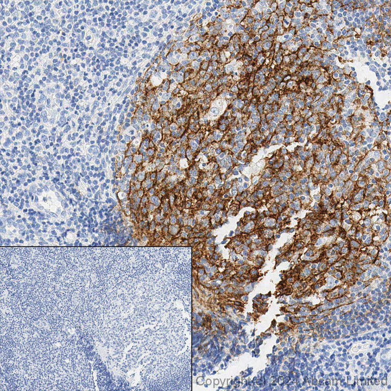 Immunohistochemistry (Formalin/PFA-fixed paraffin-embedded sections) - Anti-p75 NGF Receptor antibody [EP1039Y] - Low endotoxin, Azide free (AB221212)