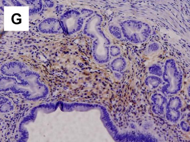 Immunohistochemistry (Formalin/PFA-fixed paraffin-embedded sections) - Anti-p75 NGF Receptor antibody [EP1039Y] - Low endotoxin, Azide free (AB221212), expandable thumbnail