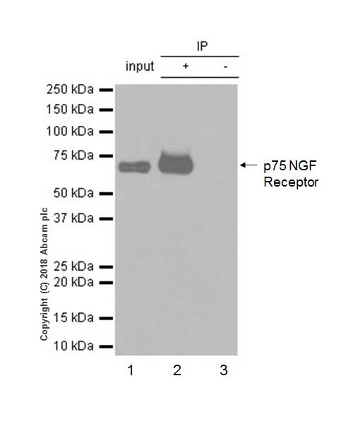 Immunoprecipitation - Anti-p75 NGF Receptor antibody [EP1039Y] - Low endotoxin, Azide free (AB221212), expandable thumbnail