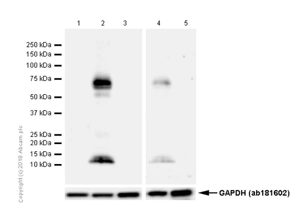Western blot - Anti-p75 NGF Receptor antibody [EP1039Y] - Low endotoxin, Azide free (AB221212)