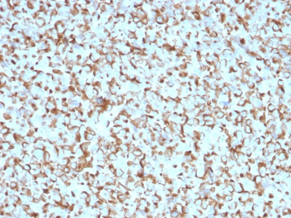 Immunohistochemistry (Formalin/PFA-fixed paraffin-embedded sections) - Anti-p75 NGF Receptor antibody [NGFR/1965] (AB224651), expandable thumbnail