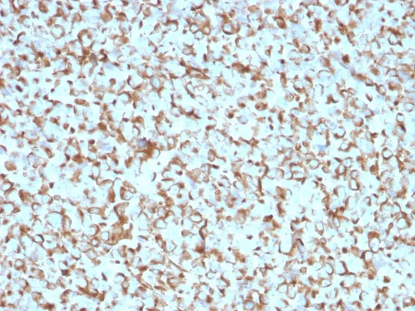 Immunohistochemistry (Formalin/PFA-fixed paraffin-embedded sections) - Anti-p75 NGF Receptor antibody [NGFR/1965] (AB224651)