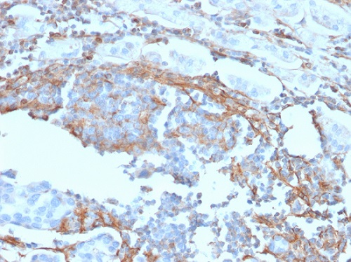Immunohistochemistry (Formalin/PFA-fixed paraffin-embedded sections) - Anti-p75 NGF Receptor antibody [NGFR/1965] - BSA and Azide free (AB224652), expandable thumbnail