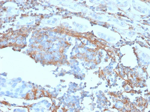 Immunohistochemistry (Formalin/PFA-fixed paraffin-embedded sections) - Anti-p75 NGF Receptor antibody [NGFR/1965] - BSA and Azide free (AB224652)