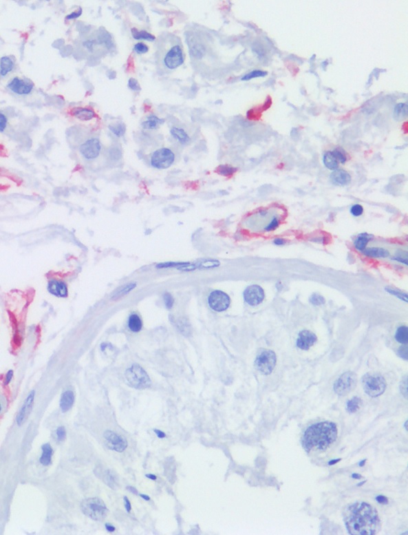 Immunohistochemistry (Formalin/PFA-fixed paraffin-embedded sections) - Anti-p75 NGF Receptor antibody [NGFR5] (AB3125)