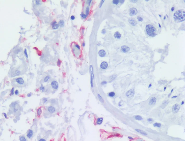 Immunohistochemistry (Formalin/PFA-fixed paraffin-embedded sections) - Anti-p75 NGF Receptor antibody [NGFR5] (AB3125)