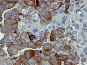 Immunohistochemistry (Formalin/PFA-fixed paraffin-embedded sections) - Anti-p75 NGF Receptor antibody [NGFR5] - BSA and Azide free (AB212682), expandable thumbnail