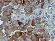 Immunohistochemistry (Formalin/PFA-fixed paraffin-embedded sections) - Anti-p75 NGF Receptor antibody [NGFR5] - BSA and Azide free (AB212682)