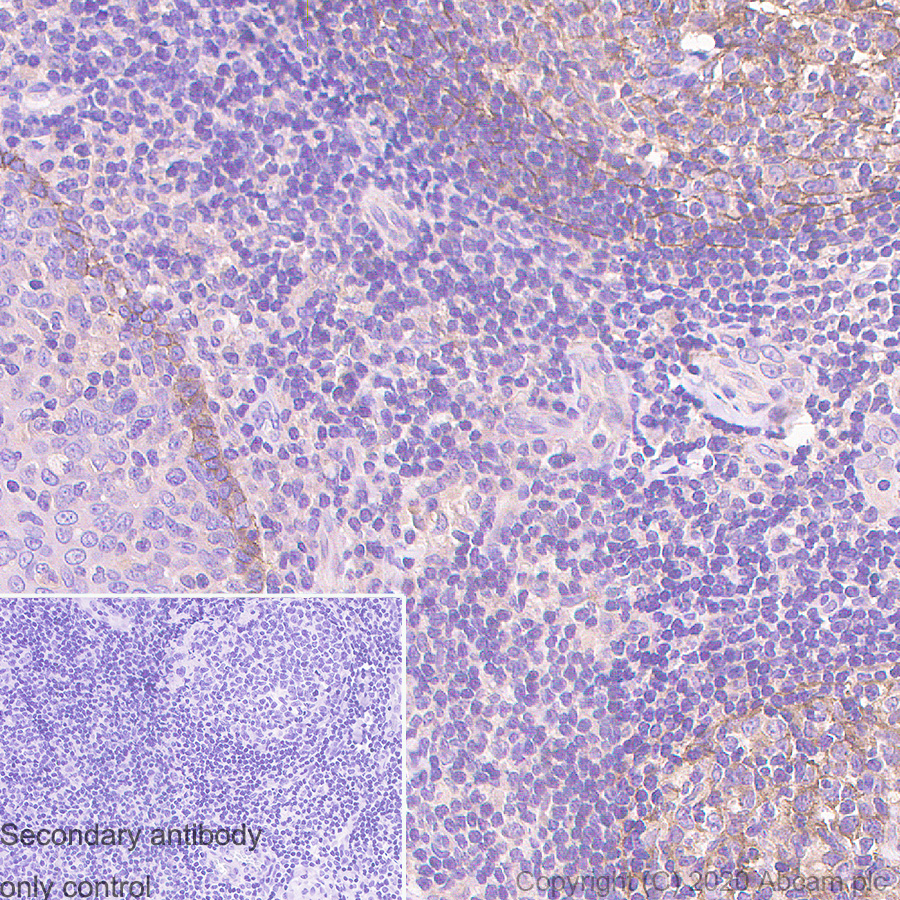 Anti-p75 NGF Receptor antibody [NORI138B]