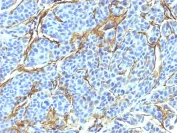 Immunohistochemistry (Formalin/PFA-fixed paraffin-embedded sections) - Anti-p75 NGF Receptor antibody [NTR/912] - BSA and Azide free (AB212684)