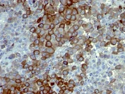 Immunohistochemistry (Formalin/PFA-fixed paraffin-embedded sections) - Anti-p75 NGF Receptor antibody [NTR/912] - BSA and Azide free (AB212684)