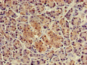Immunohistochemistry (Formalin/PFA-fixed paraffin-embedded sections) - Anti-p8/NUPR1 antibody (AB234696), expandable thumbnail