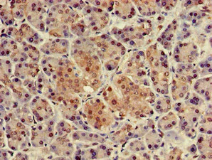 Immunohistochemistry (Formalin/PFA-fixed paraffin-embedded sections) - Anti-p8/NUPR1 antibody (AB234696)