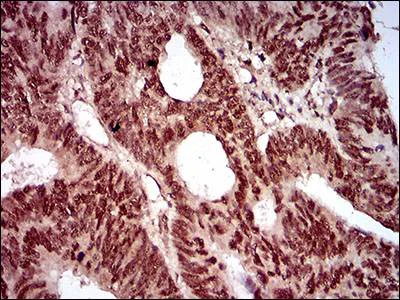 Immunohistochemistry (Formalin/PFA-fixed paraffin-embedded sections) - Anti-p95/NBS1 antibody [7E4A2] (AB181729)