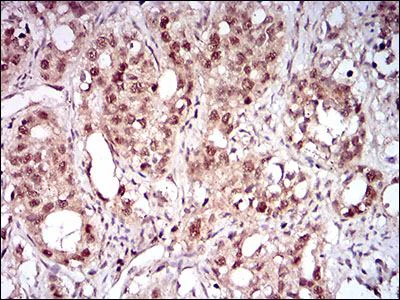 Immunohistochemistry (Formalin/PFA-fixed paraffin-embedded sections) - Anti-p95/NBS1 antibody [7E4A2] (AB181729)