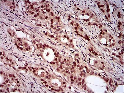 Immunohistochemistry (Formalin/PFA-fixed paraffin-embedded sections) - Anti-p95/NBS1 antibody [7E4C2] (AB181780)
