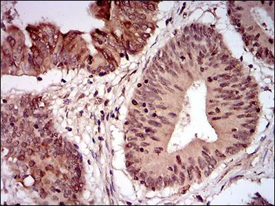 Immunohistochemistry (Formalin/PFA-fixed paraffin-embedded sections) - Anti-p95/NBS1 antibody [7E4C2] (AB181780)