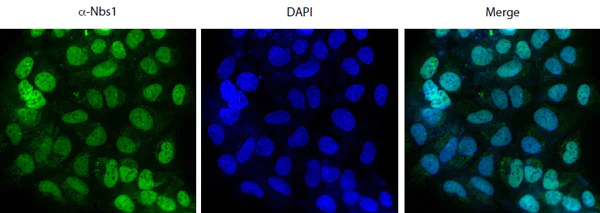 Immunocytochemistry/ Immunofluorescence - Anti-p95/NBS1 antibody (AB175800)