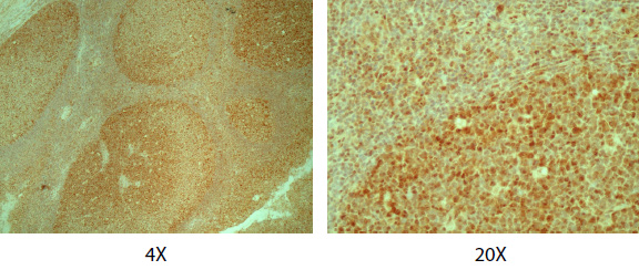 Immunohistochemistry (Formalin/PFA-fixed paraffin-embedded sections) - Anti-p95/NBS1 antibody (AB175800)