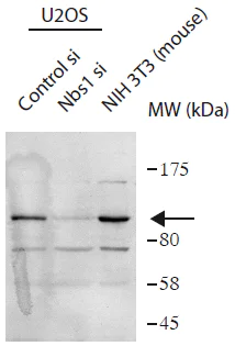 Western blot - Anti-p95/NBS1 antibody (AB175800)