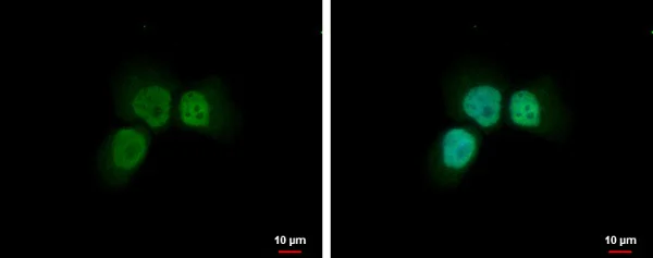 Immunocytochemistry/ Immunofluorescence - Anti-p95/NBS1 antibody (AB227068)