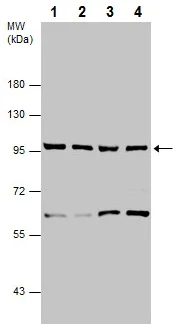 Western blot - Anti-p95/NBS1 antibody (AB227068)