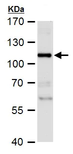 Western blot - Anti-p95/NBS1 antibody (AB227068)