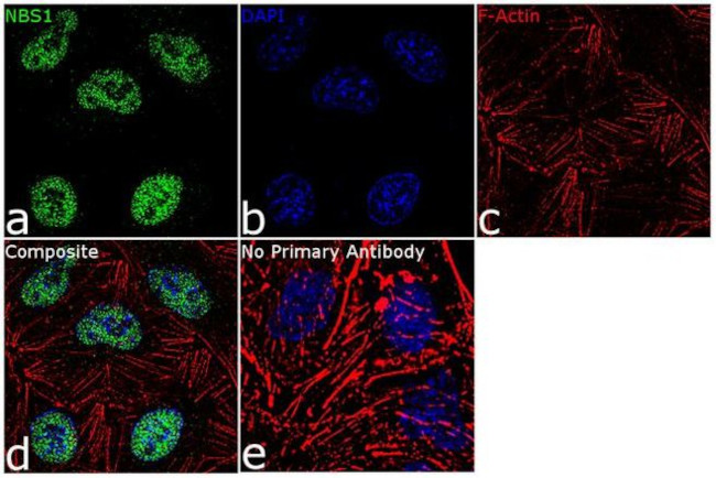 Immunocytochemistry/ Immunofluorescence - Anti-p95/NBS1 Antibody [RP23040230] (AB313492), expandable thumbnail
