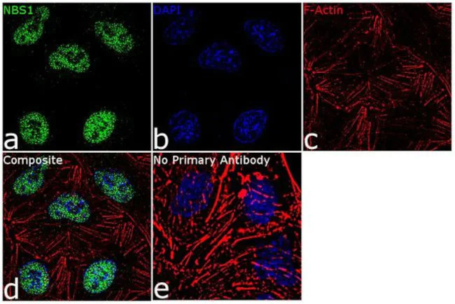 Immunocytochemistry/ Immunofluorescence - Anti-p95/NBS1 Antibody [RP23040230] (AB313492)